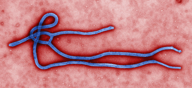 The Ebola virus / Photo: Flickr user The Global Panorama, courtesy Centers for Disease Control and Prevention's Public Health Image Library, Released into the public domain | Wikimedia Commons